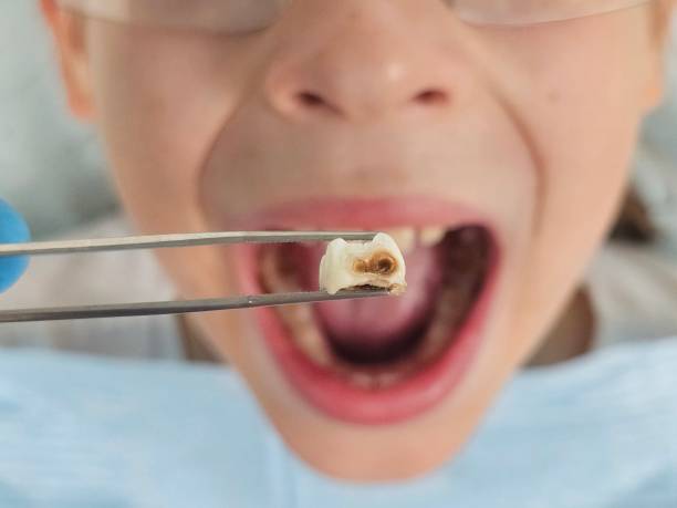 Best Knocked-Out Tooth Emergency  in Ralston, NE